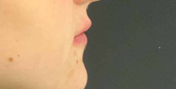 Before
