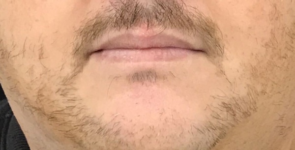 Before