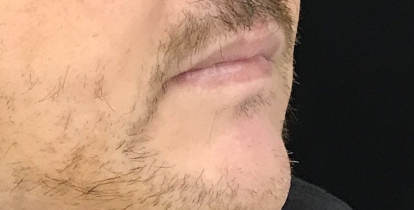 Before