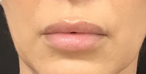 After