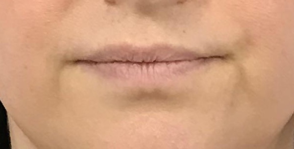 Before